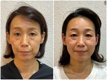 美容整体 ウェリナ 蟹江院/小顔矯正/骨盤矯正/美脚サロン 