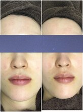 ビー 銀座一丁目駅店(Bee)/