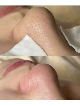 ルルアス(LULUAS)/小岩駅2分癒しサロン ルルアス