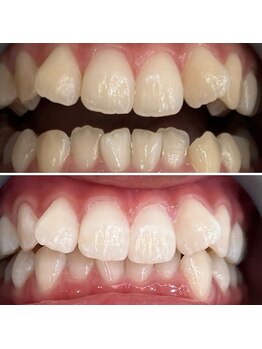 シャイニー 仙台駅東口(SHINY)/お客様の変化