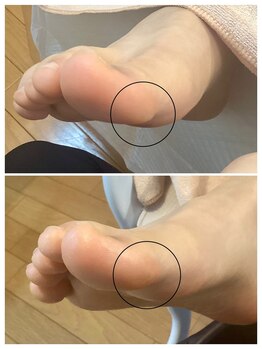ドクターネイル爪革命 麻布十番店/【たこケア】フットケア