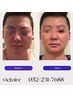 男性はこちら→メンズ大人気小顔SP　コルギ　お肉痩せどちらか　80分¥7,200