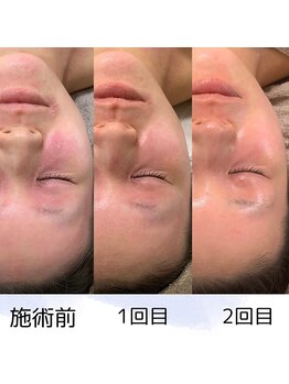 ニコ(25)/変化写真