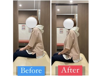 ナオル整体 宮崎院(NAORU整体)/40代女性施術事例【猫背改善】