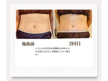 ルル リラクゼーション(RURU Relaxation)/ダイエット/ウエスト/全身/