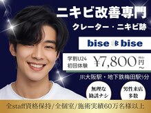 ビズビズ(bisebise)