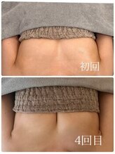 美人バスト 新潟店/ 【バストアップ★育乳】症例