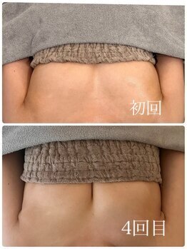 美人バスト 新潟店/ 【バストアップ★育乳】症例