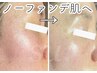 【通常価格】ツヤ肌ハーブ◎デコルテ(肩首)アロマトリートメント付¥12500