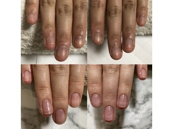 スリーエススタイルズ(3s Styles)/深爪ケア