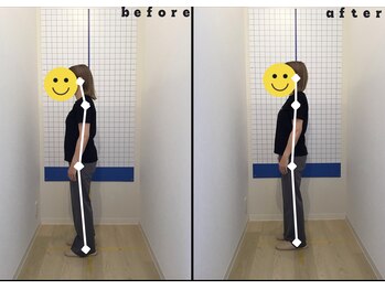 今津ぴっと骨盤整体院/ビフォーアフター2