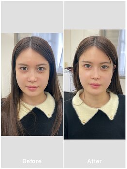 名古屋鍼灸 美容健康院/ビフォーアフター