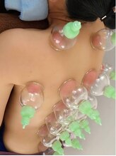 ハリ ヴァカンス(Hari Vacances)/鍼灸施術