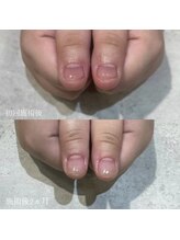 イル(iLL)/自爪育成～ジェルコース～