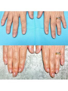 ハッカネイル(HAKKA NAIL)/