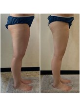 ヴィオテラス(VIOTERACE)/２ヶ月ダイエット☆