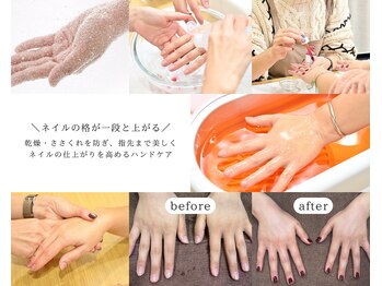 ニコッテ 本厚木(nicotte.)の写真/ワントーン明るくなった手肌で自分の手が好きになる♪本厚木