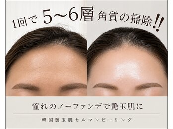 キューレット(CULET)の写真/韓国発・角質を整頓するセルマン♪つるんと輝く憧れの艶玉肌へ