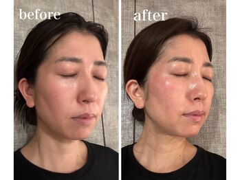 パルフェット(parfaite)/ララピール