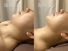 カルニッコ(Kalnicco)の雰囲気（美肌はもちろん筋肉にもアプローチする小顔フェイシャルも人気）