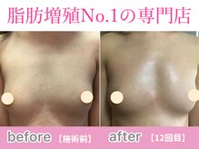 サラエクセレント 心斎橋(SARA EXCELLENT)/左右差改善でバストアップ！育乳