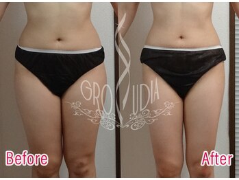 グラウディア 恵比寿/痩身/筋膜リリース/インディバ超