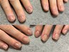 自爪育成モニター募集【深爪/噛み爪/むしり爪】ハンドケア付き¥13000→￥9800