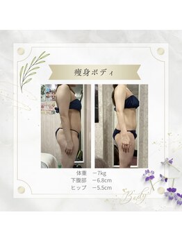 アディッシモ(addissimo)/二の腕ほっそり☆