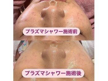 リボーン(REBORN)