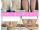 小顔専門店Lift(リフト)柏の写真