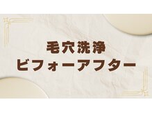 ビエル(Bielle)/開き毛穴つまり黒ずみざらつき