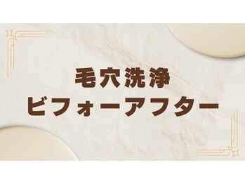 ビエル(Bielle)/開き毛穴つまり黒ずみざらつき