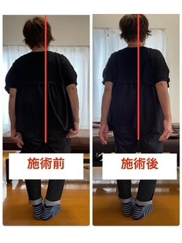 にこ。/整体による姿勢の変化