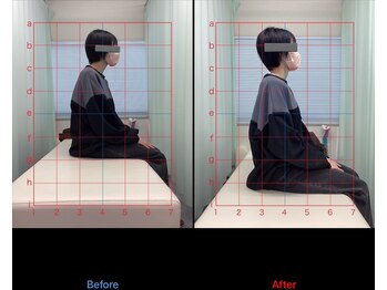 ナオル整体 名古屋金山院(NAORU整体)/【金山】猫背を解消したい方