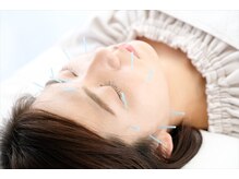 きよらか鍼灸接骨院/痛みの少ない美容鍼で肌代謝UP