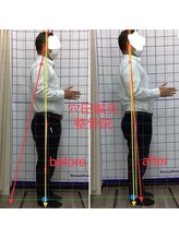 穴田鍼灸整骨院/整体・骨盤・ねこぜ・まき肩矯正