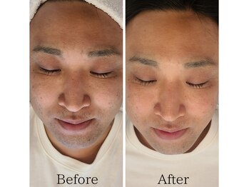 サロンド シェリー(Salon de Cherie)/ララピール