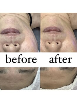 フェリーチェネイル(felice Nail)/フェイシャル