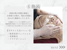 リライン(ReLine)/【施術】