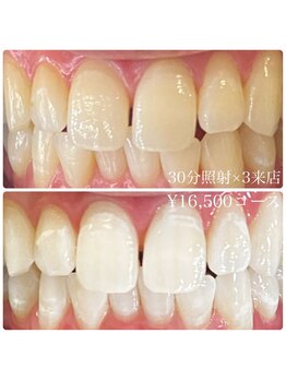 ホワイトニングルーム 横浜店(Whitening Room)/セルフホワイトニング/横浜