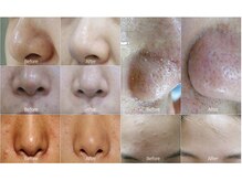 クレール 小山店(CLAIR)/【水光アクア+白玉酸素ドーム】