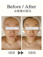 ココプレジール(Cocoplaisir)/くすみ/毛穴