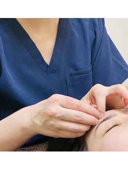 いなば整復院の写真/目の周りがすっきりします。毎日の化粧ノリがよくなりますよ☆ご体験を！