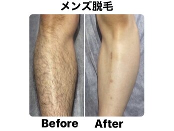 ネオファースト(NeoFirst)/Men‘s！！