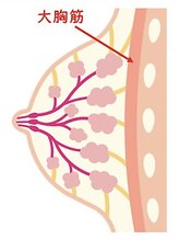 【原因１★　大胸筋にバストが癒着している】
