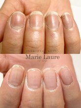 マリーロール 淀屋橋本店(Marie Laure)/自爪育成/深爪矯正/ネイルケア
