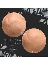 ルルマル(lulumalu)/マーメイドセルトリートメント