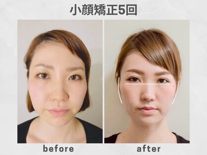ビトリア 小顔 骨盤美容矯正サロン(BITORIA)の写真