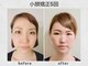 ビトリア 小顔 骨盤美容矯正サロン(BITORIA)の写真