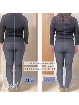 リセット(Reset)/気になる太もも・お尻まわりに